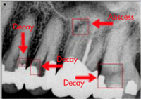 Digital X-Ray
